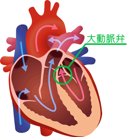 Tavi 経カテーテル大動脈弁植え込み術 新東京病院