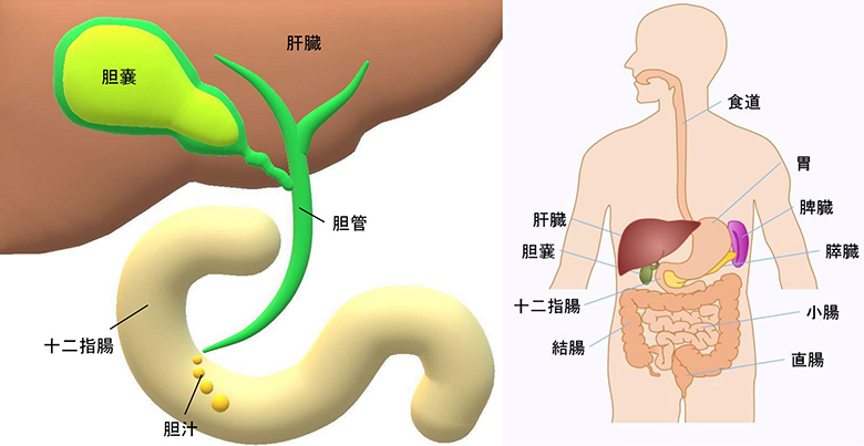 摘出 胆嚢