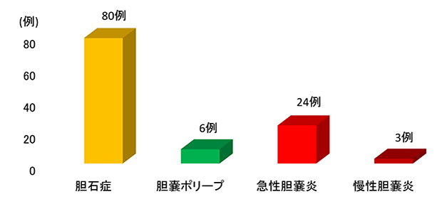 ポリープ 胆嚢